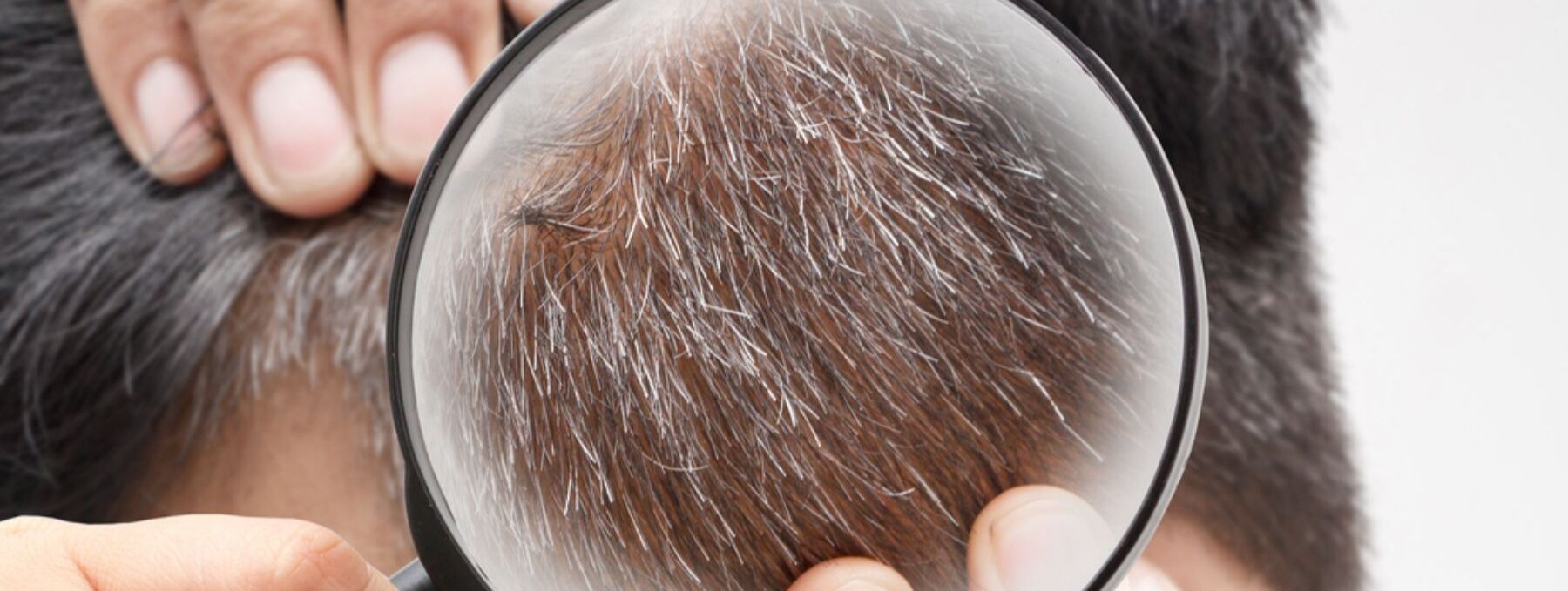 tissue-aging-and-gray-hair-determined-by-biological-clock