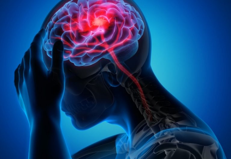 new-research-confirms-too-much-sleep-raises-stroke-risk-chronobiology